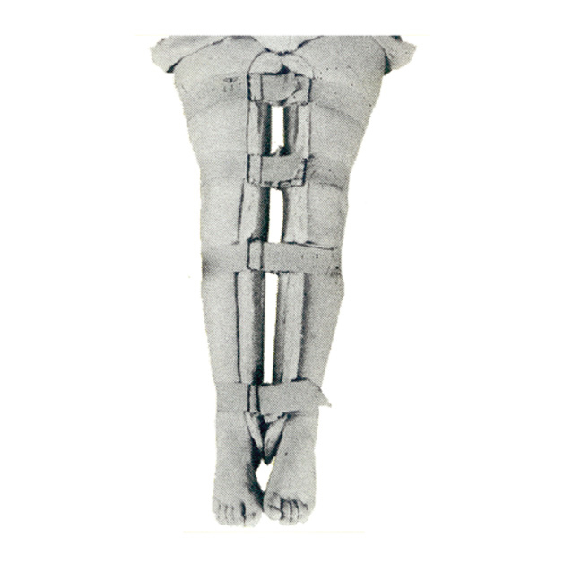 Mermaid Splint For Bow Leg